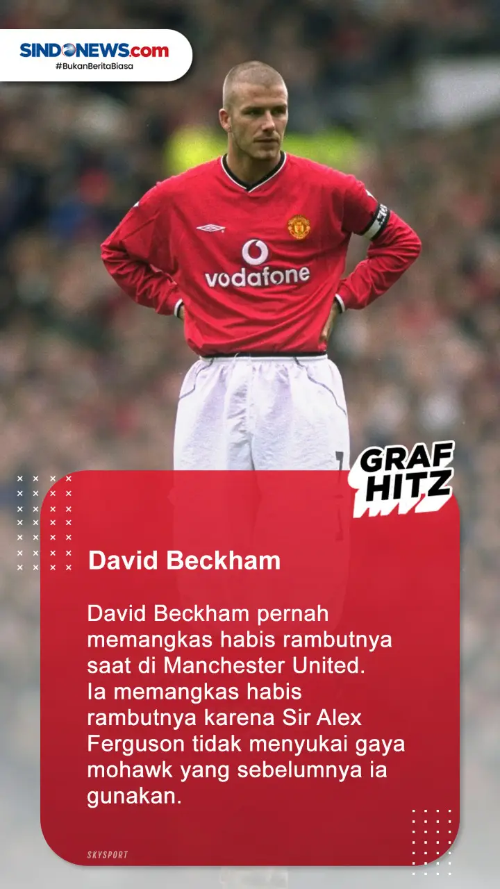 5 Pesepakbola Botak...