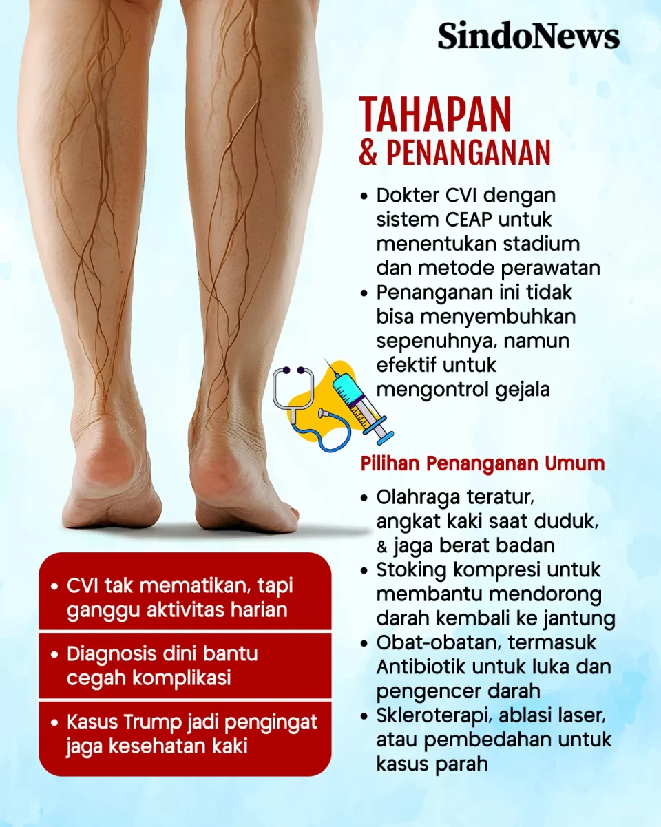 Chronic Venous Insufficiency,...