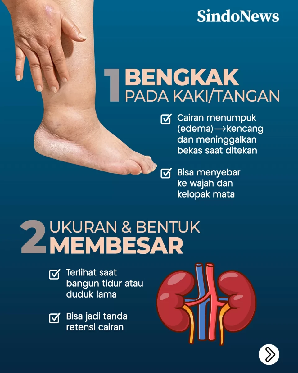 7 Gejala Awal Penyakit...