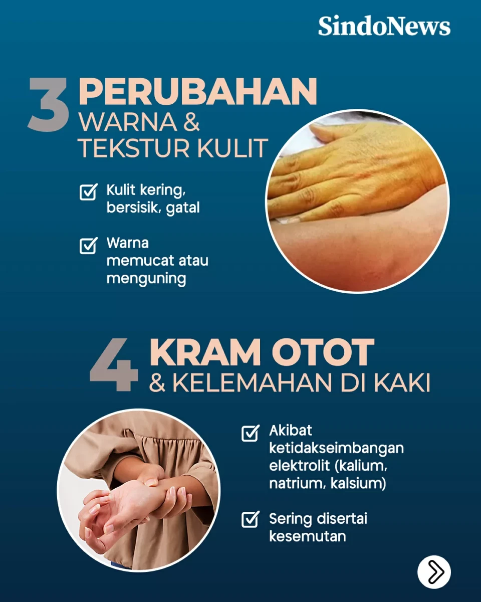 7 Gejala Awal Penyakit...